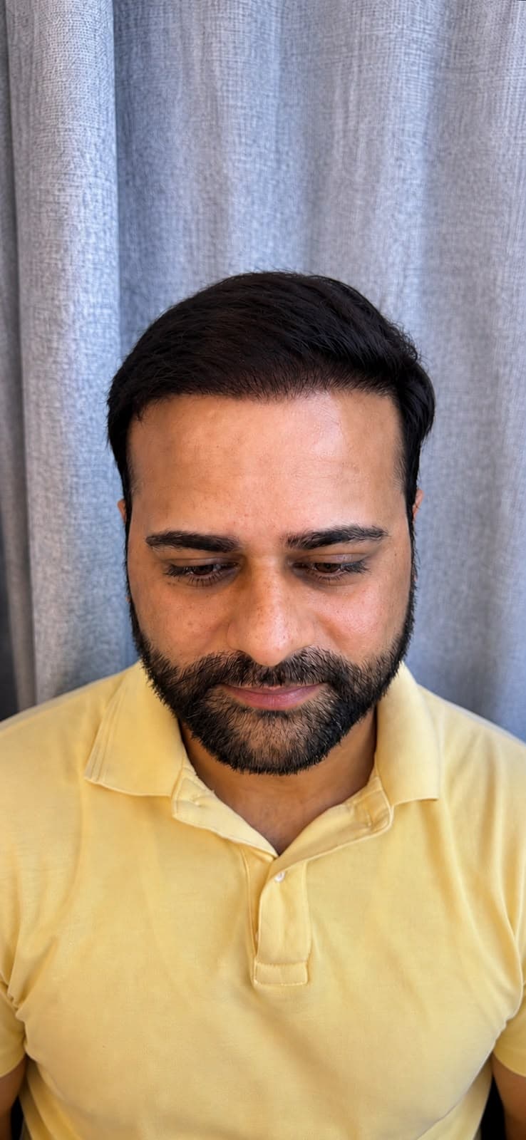 A fuller head of hair starts with the right plan. after