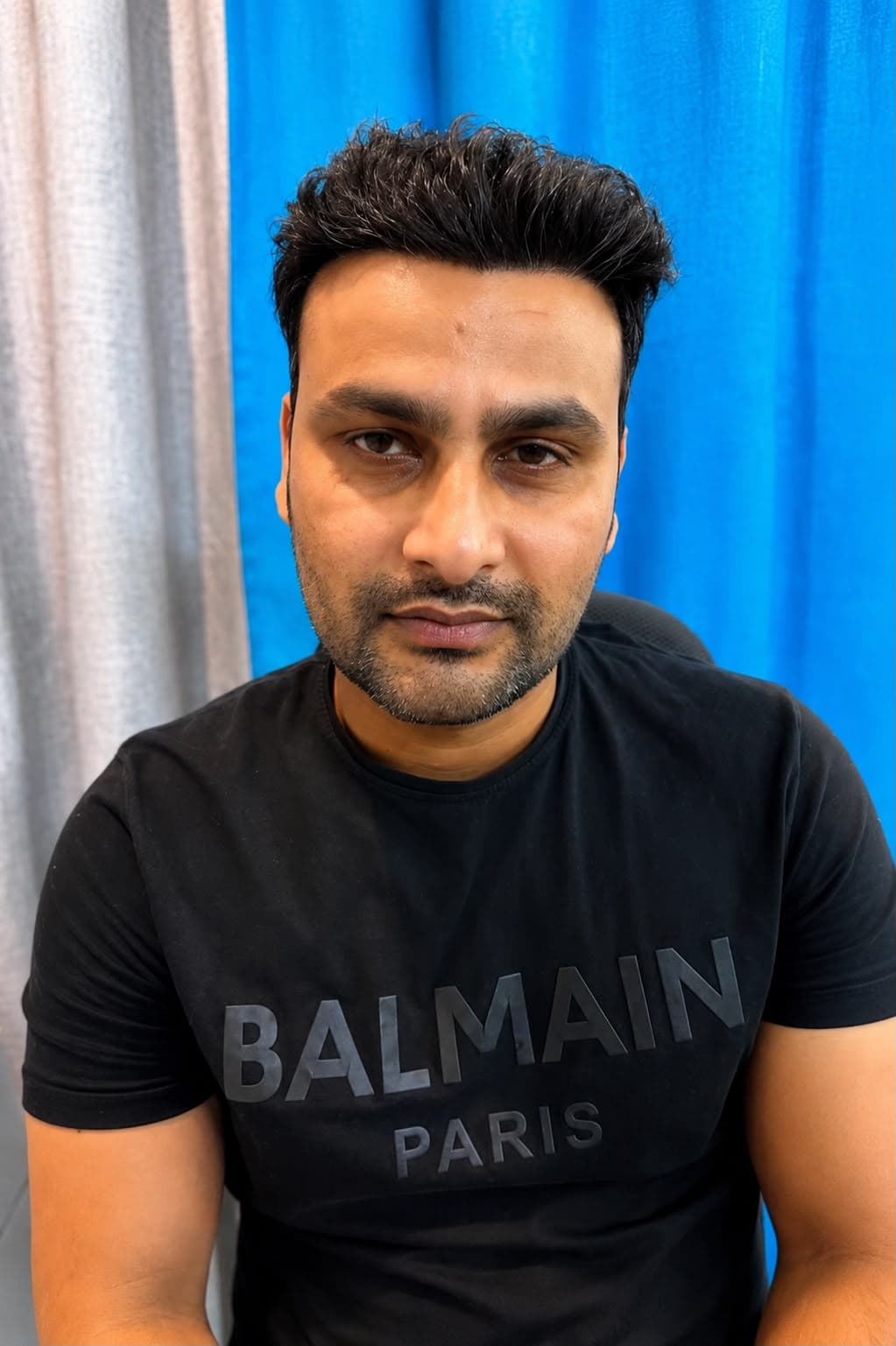 Patient after hair restoration