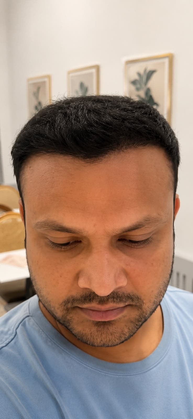 Turn thinning into fuller, natural-looking hair. after